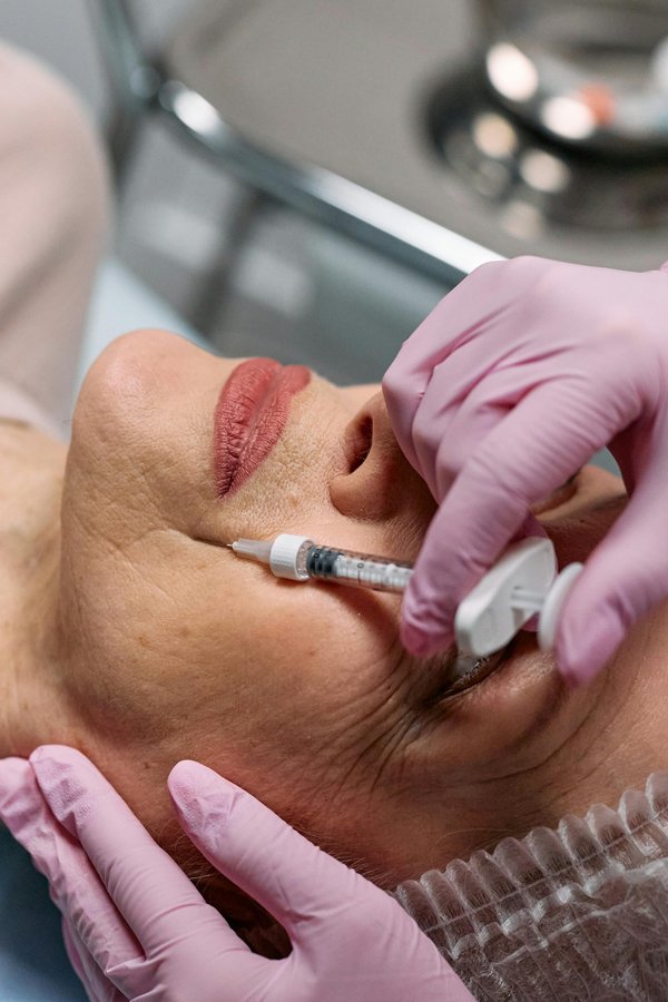 Revitalize your look with harley street dermal fillers